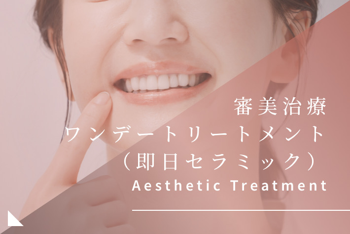 審美治療・ワンデートリートメント（即日セラミック）