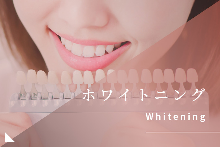ホワイトニング｜岡崎市の歯医者